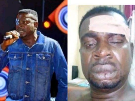 Baba Fryo Battered & Assaulted By 'Unknown' Soldiers In Lagos