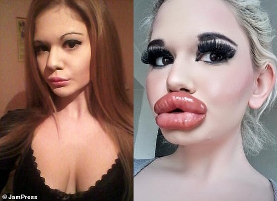 Real-Life Barbie' Andrea Ivanova" with the 'biggest lips in the world' shows off huge new pout after 20th filler Injection